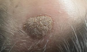 ultrasun-tanning-and-beauty-chester-saltney